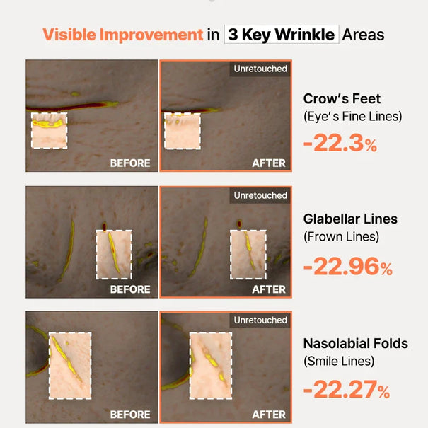 COSRX 5 PDRN Hyaluronic Acid Vital Hydrating Hydrogel Mask