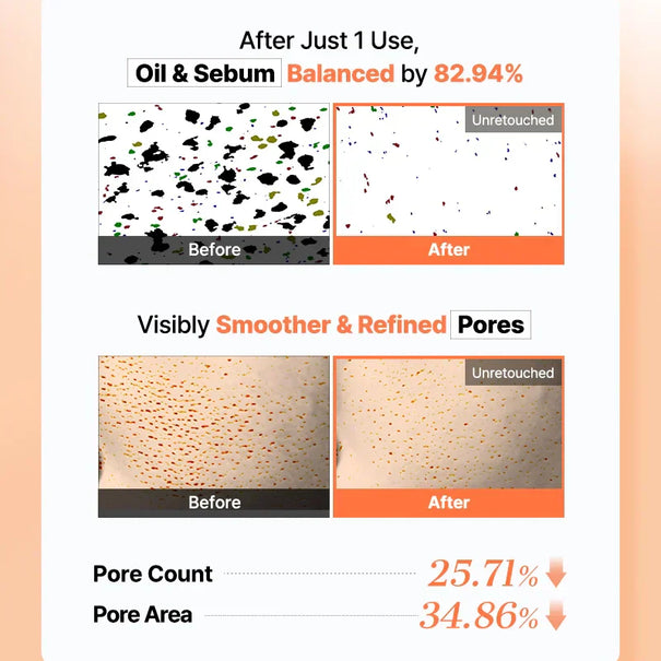 COSRX 5 PDRN Hyaluronic Acid Vital Hydrating Hydrogel Mask