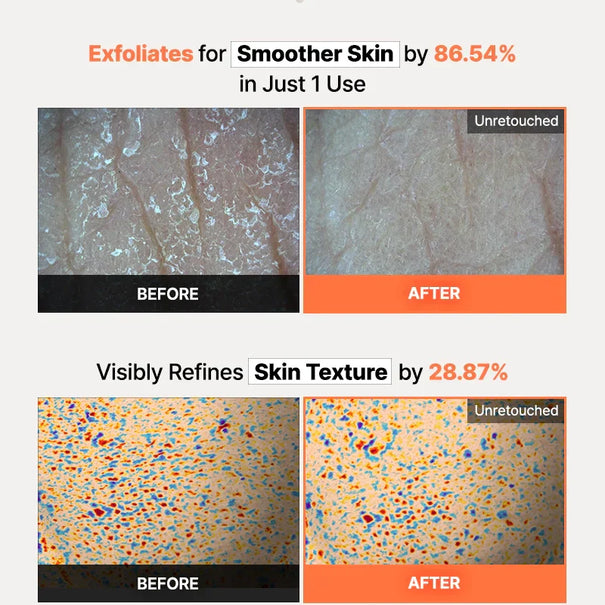 COSRX 5 PDRN Hyaluronic Acid Vital Hydrating Hydrogel Mask