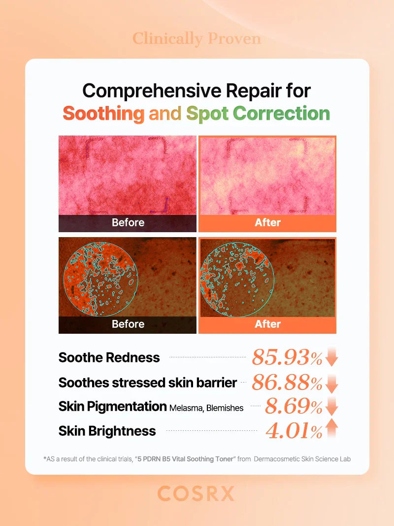 COSRX 5 PDRN B5 Vital Soothing Toner 280 ML