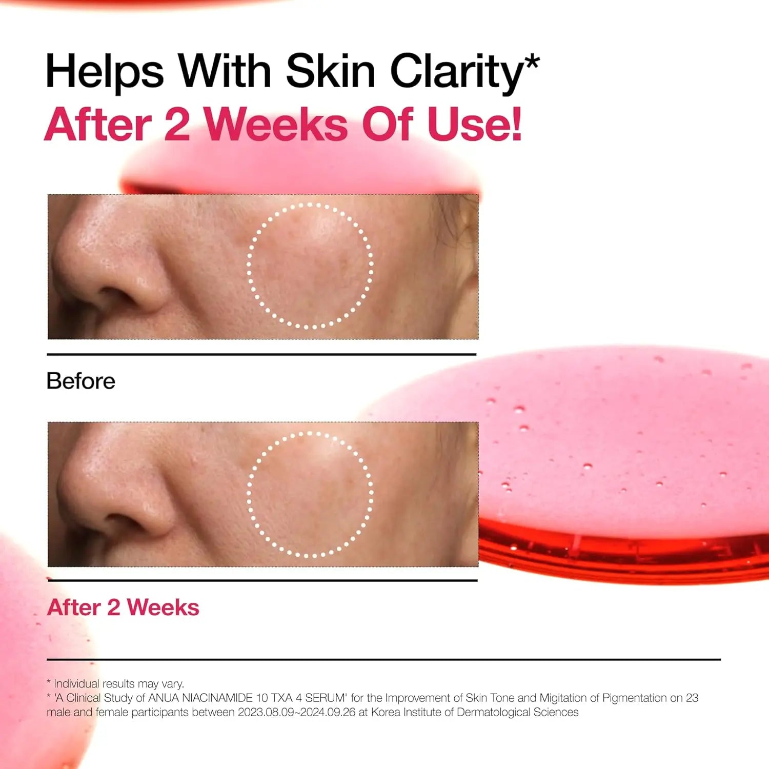 ANUA Niacinamide 10% + TXA 4% Serum 30 ML Anua JOLIE'S