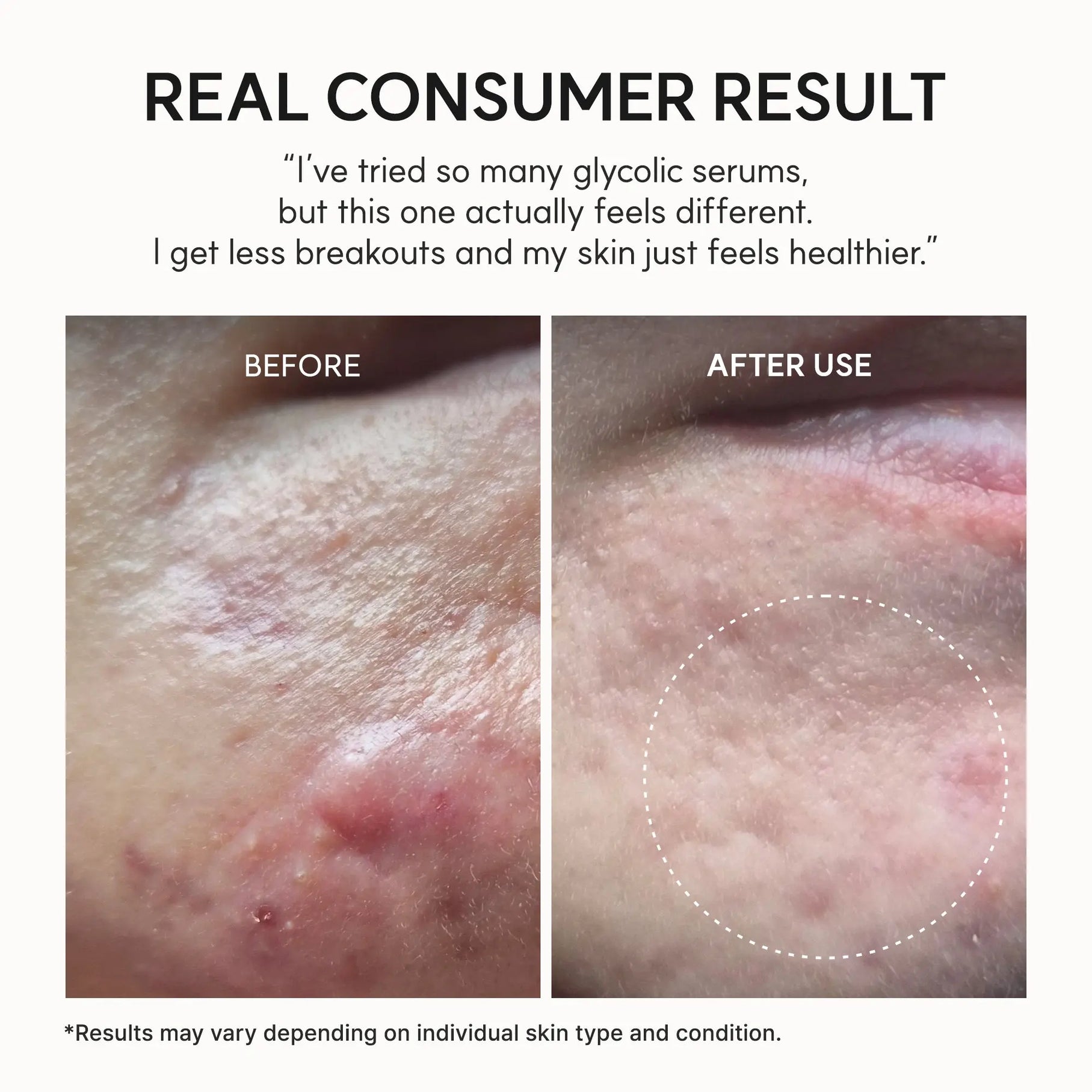 ARENCIA Eraser Shot Glycolic Acid Booster in 30ml bottle, clear liquid skincare product for exfoliation and skin renewal.