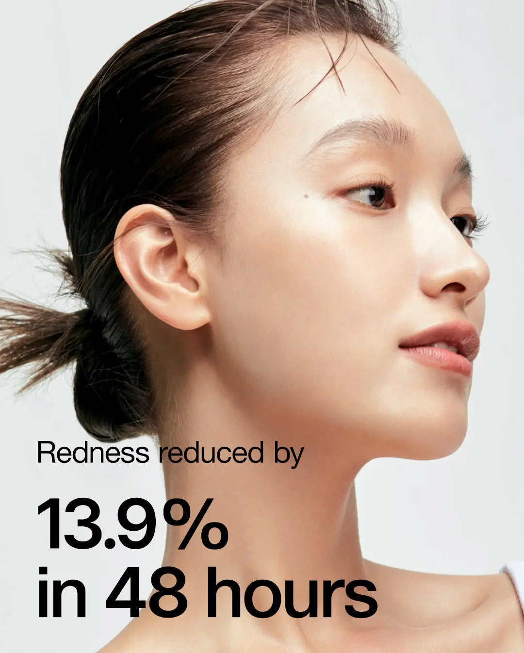 Anua Heartleaf 77% Soothing Toner 250 ml - JOLIE'S