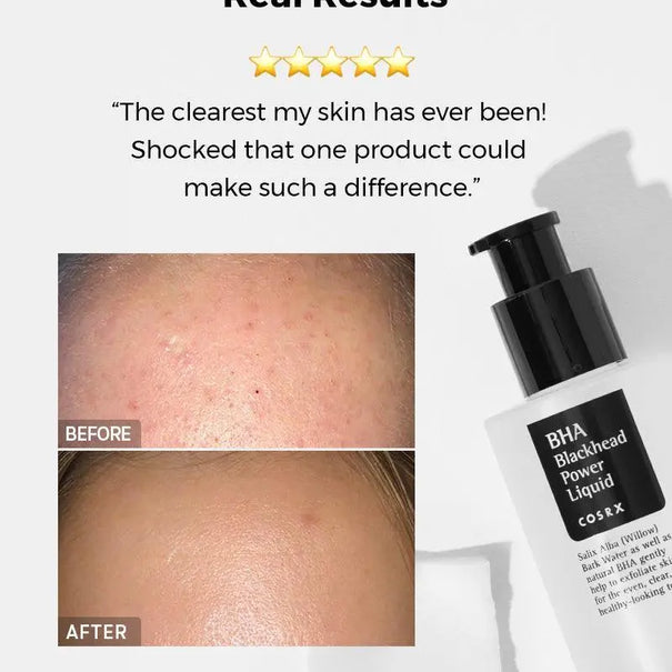 COSRX BHA Blackhead Power Liquid 100 ml - JOLIE'S