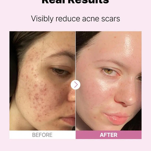 COSRX The Niacinamide 15 Serum 20 ml - JOLIE'S