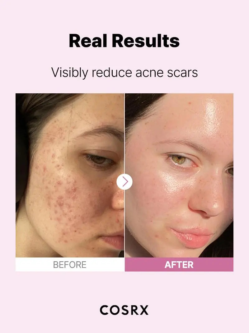 COSRX The Niacinamide 15 Serum 20 ml - JOLIE'S