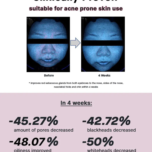 COSRX The Niacinamide 15 Serum 20 ml - JOLIE'S