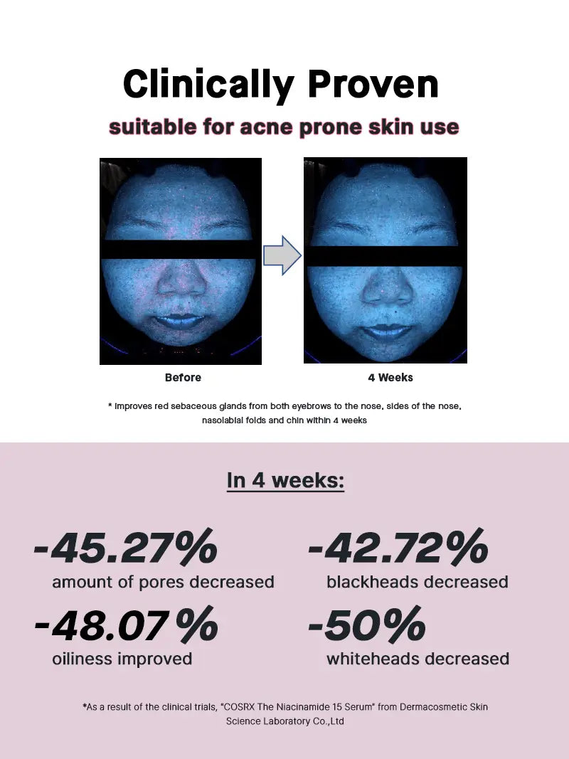 COSRX The Niacinamide 15 Serum 20 ml - JOLIE'S
