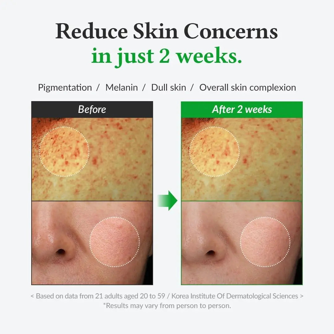 DOKAN DR ALTHEA Gentle Vitamin C Serum DR ALTHEA