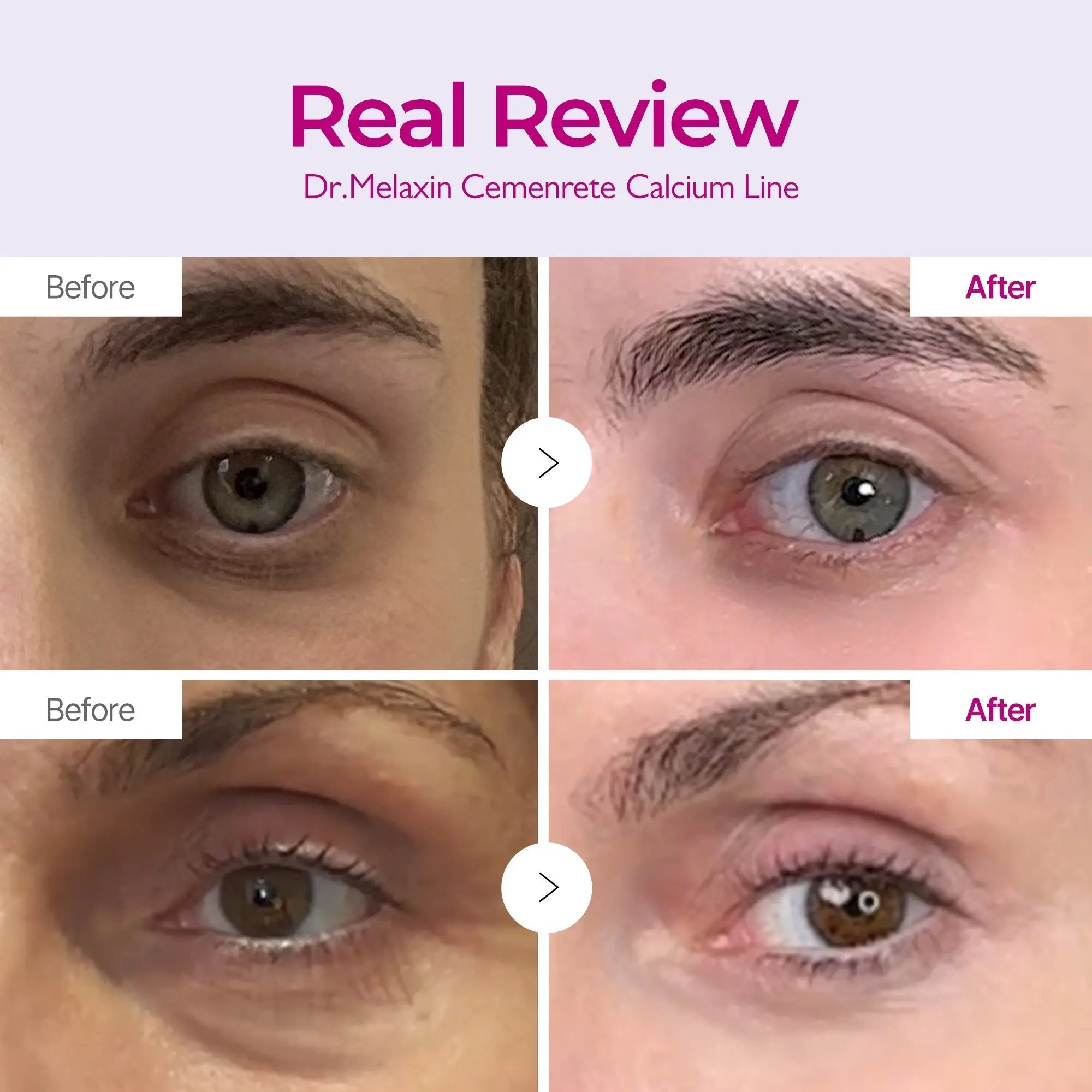 Dr.Melaxin Calcium Eyecare Routine Set - DOKAN
