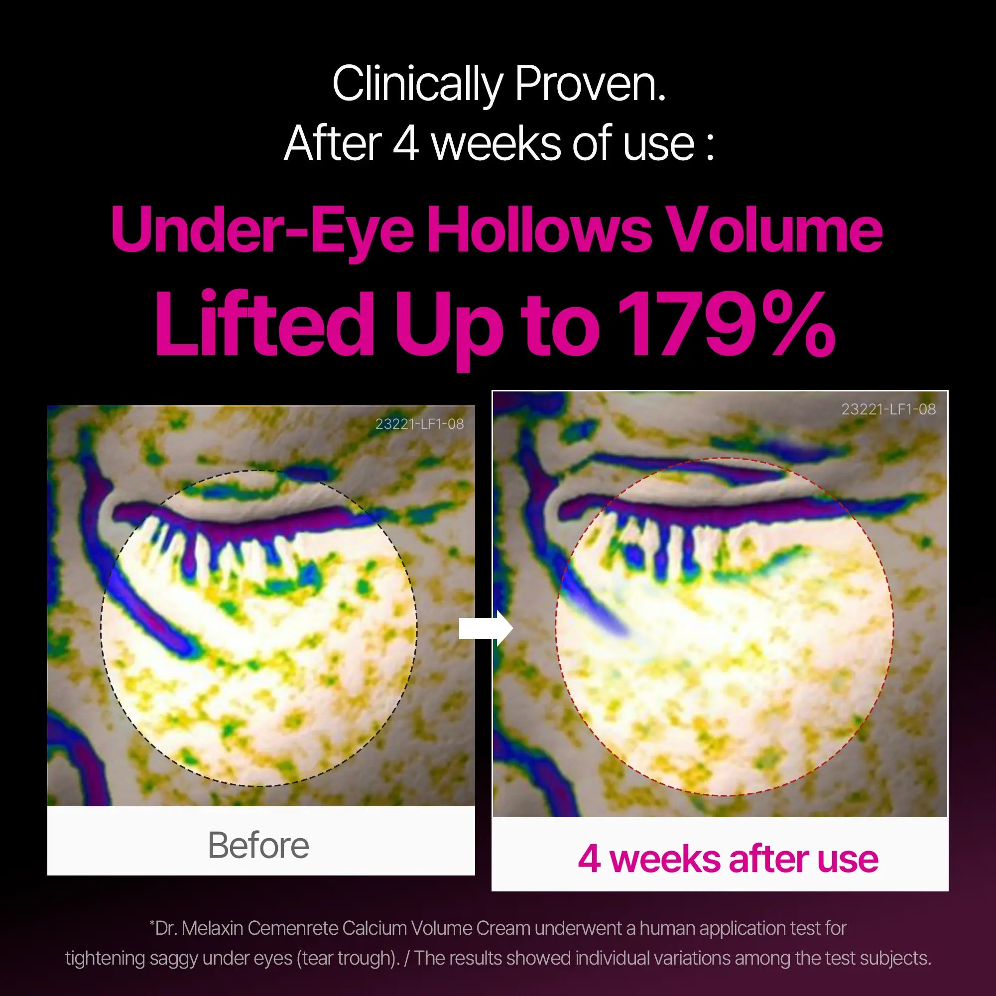 Dr.Melaxin Calcium Eyecare Routine Set - DOKAN