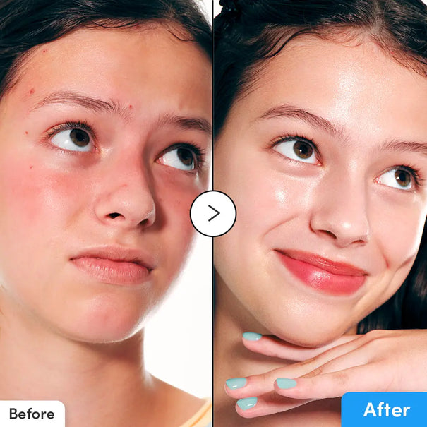 EQQUALBERRY Blue Blow Hyaltoin Flooding Serum 30ml EQQUALBERRY JOLIE'S