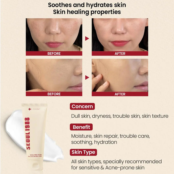 KSECRET SEOUL 1988 Cream: Snail Mucin 93% + Rice (100ml) KSECRET SEOUL 1988 JOLIE'S