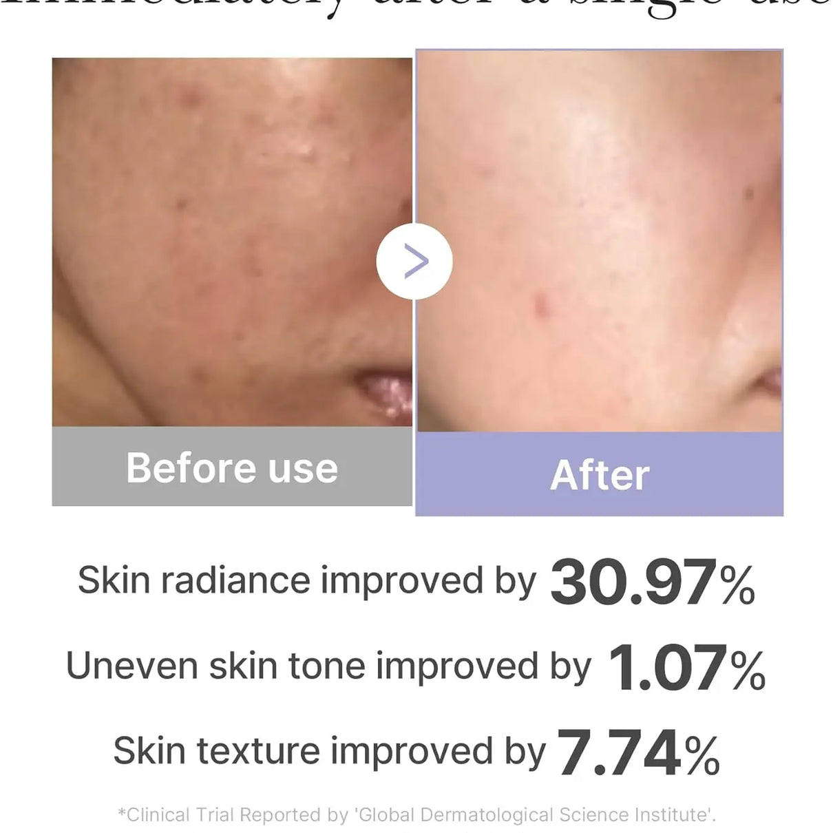 MEDICUBE AGE R Booster Pro Mini Medicube JOLIE'S