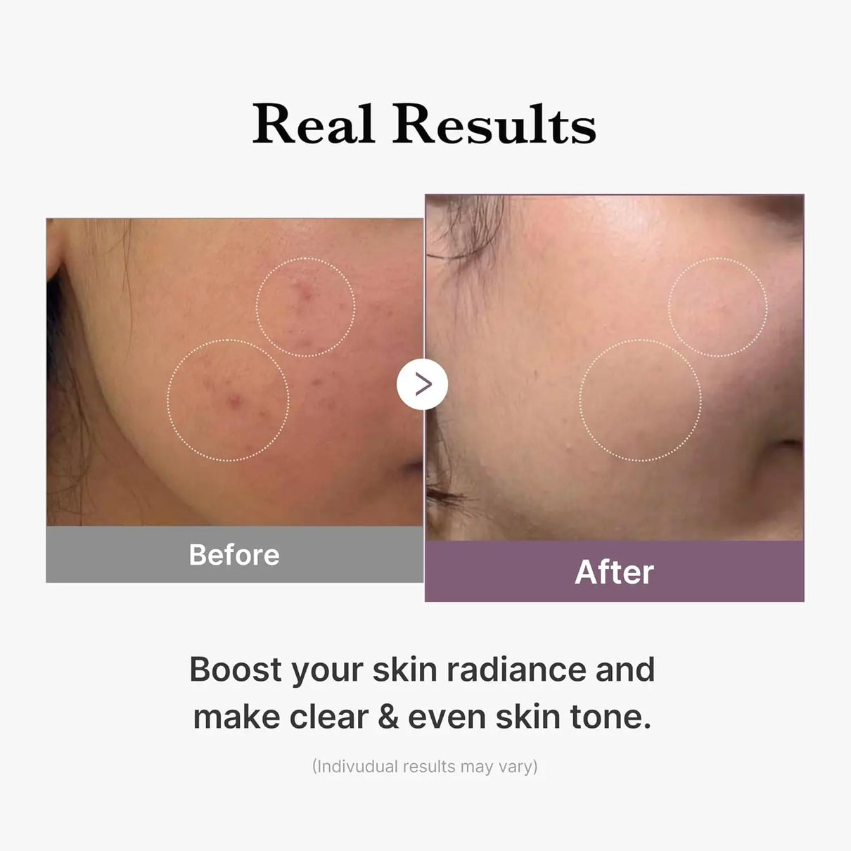 MEDICUBE Age-R Glutathione Glow Toner 140 ML Medicube JOLIE'S