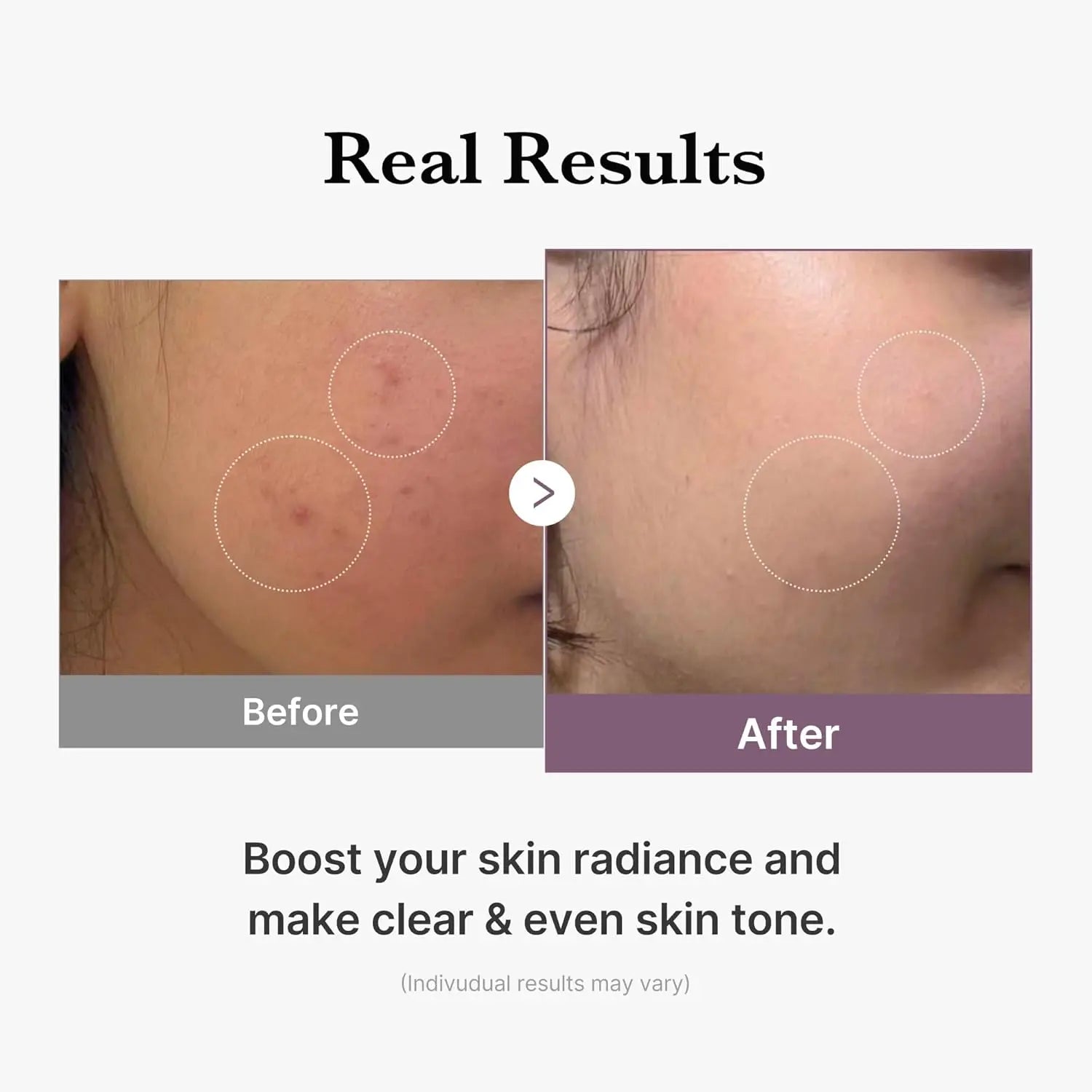 MEDICUBE Age-R Glutathione Glow Toner 140 ML Medicube JOLIE'S