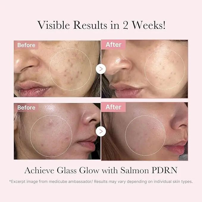 MEDICUBE PDRN Glow Kit Medicube JOLIE'S