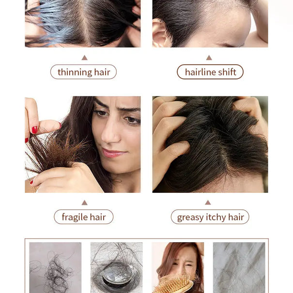 NUSPA Anti Hair Loss Hair Care Set with Herbal Shampoo, Serum & Massage Comb NUSPA JOLIE'S