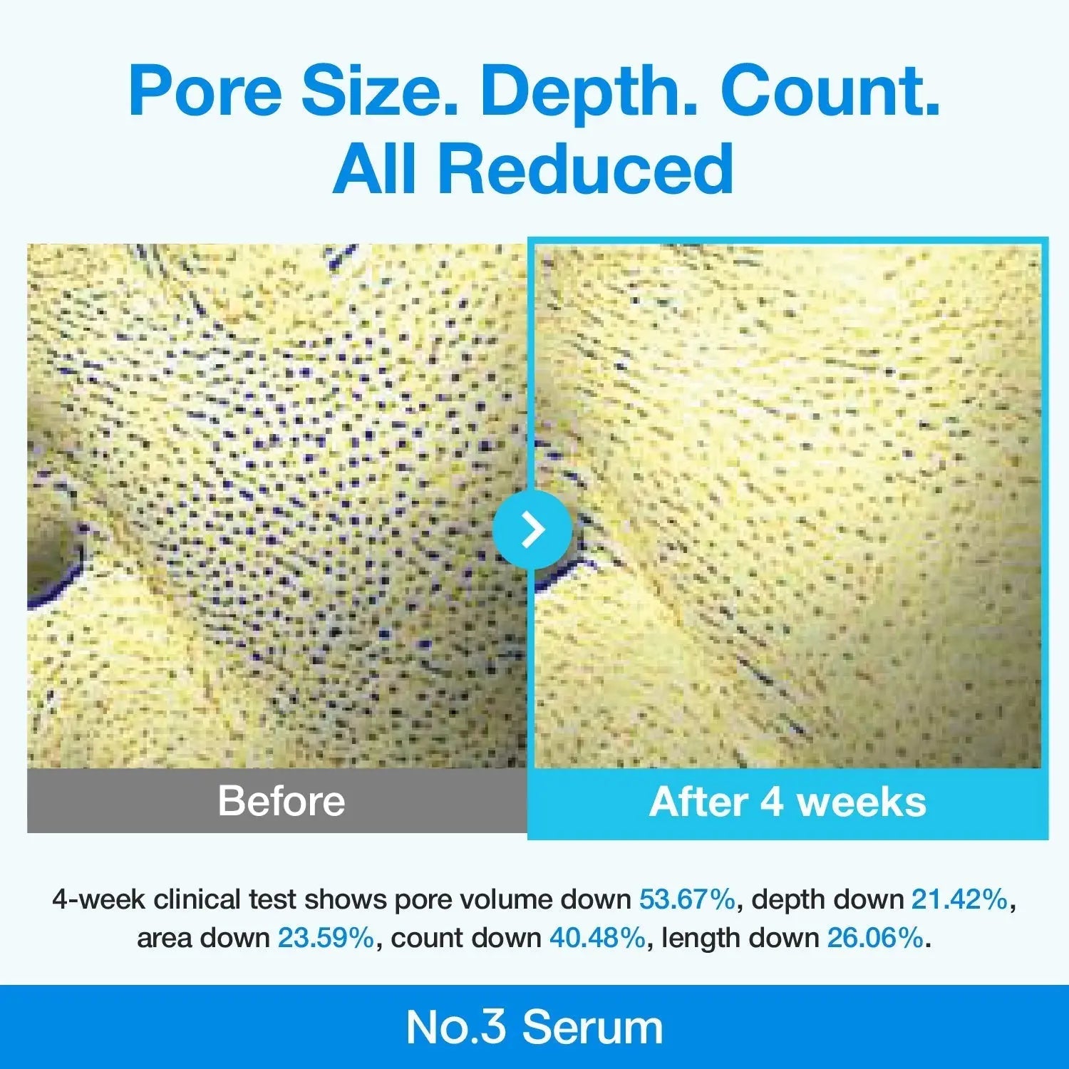 Numbuzin No.3 Blue Bio-Retinol Pore Refining Serum 30ml Numbuzin