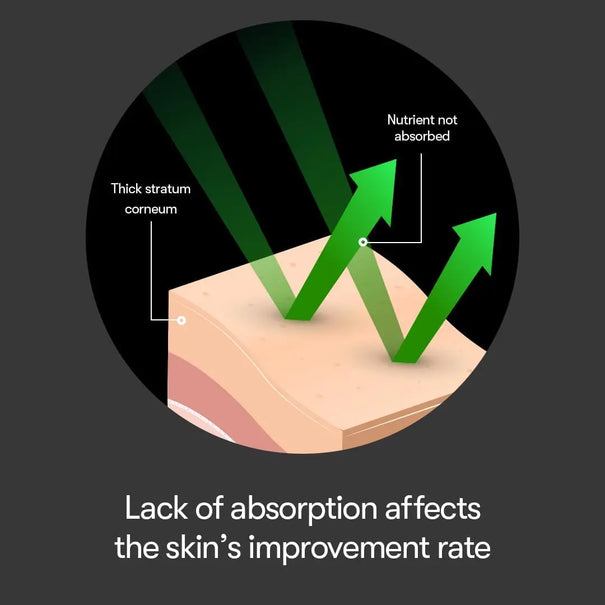 DOKAN VT REEDLE SHOT 100 VT REEDLE SHOT